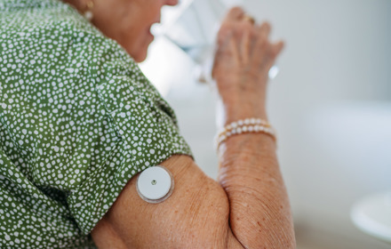 Elderly Woman Using CGM On Arm