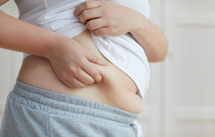 Obesity Image